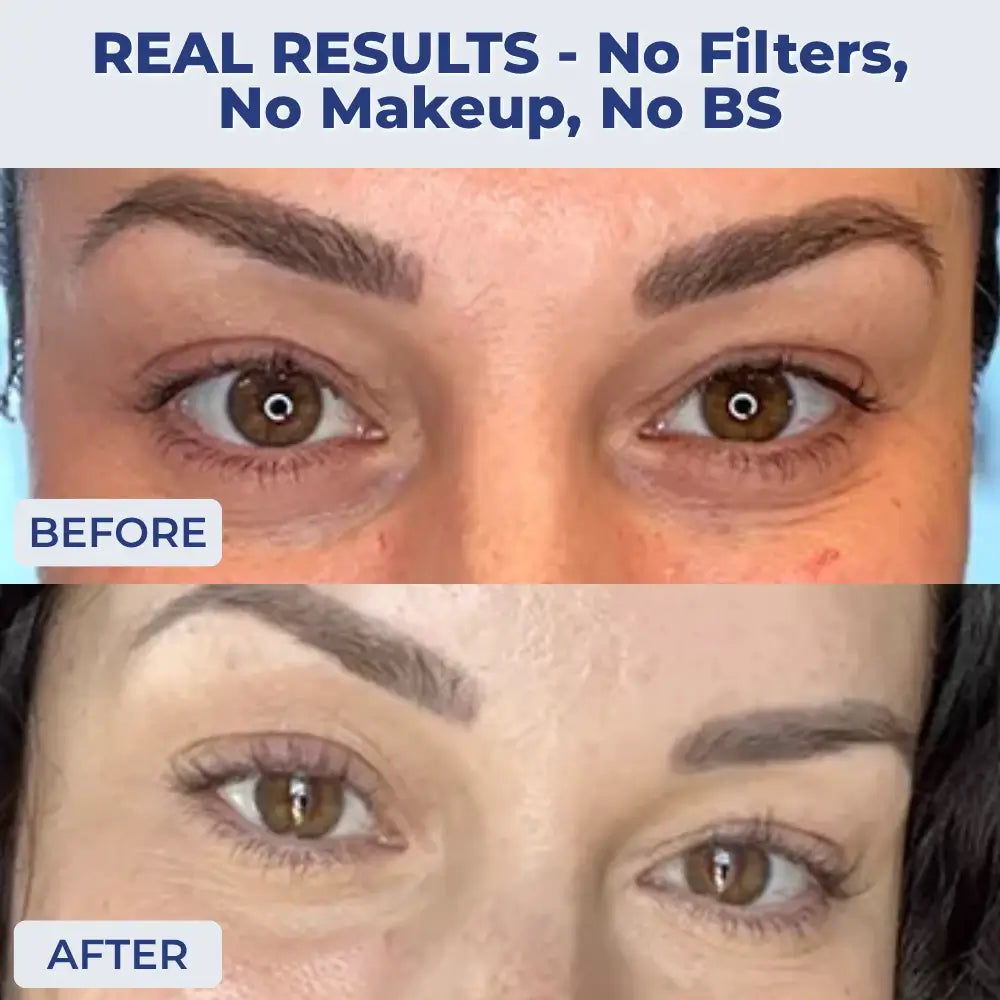 Get Eyes That Look 10 Years Younger (in Just 15 Minutes)